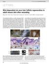 Wnt-Dependent De Novo Hair Follicle Regeneration in Adult Mouse Skin After Wounding