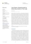 Case Report: Bimekizumab for Dissecting Cellulitis of the Scalp