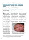 Superficial Squamous Cell Carcinomas and Extensive Actinic Keratoses of the Scalp Treated with Radiation Therapy