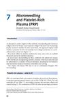 Microneedling and Platelet-Rich Plasma (PRP)