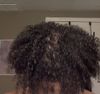 Is my hair loss from itching/shampoo or am I just balding?