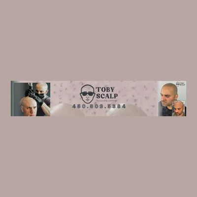 Toby Scalp - Micropigmentation, Tatouage Capillaire