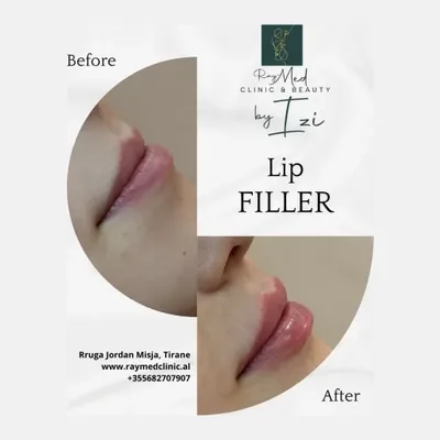 Raymed Clinic & Beauty by IZI