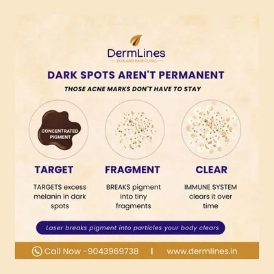 Dermlines Skin & Hair Clinic