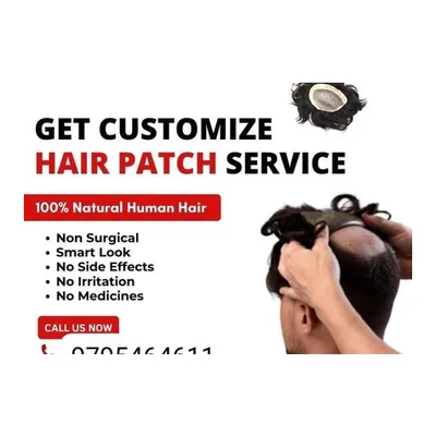 KGN Hair Patch Replacement Center