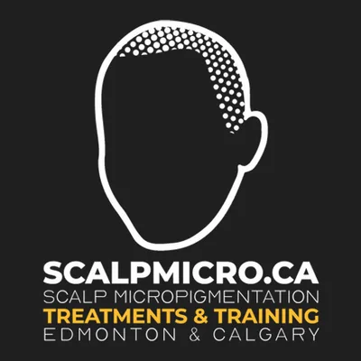 SCALPMICRO Scalp Micropigmentation Edmonton