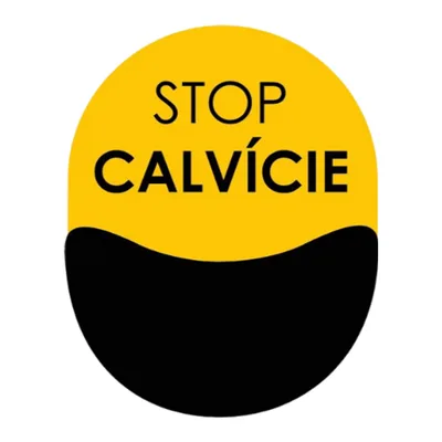Stop Calvície Campinas
