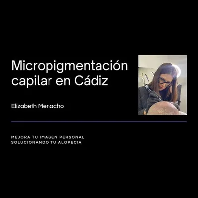 Micropigmentación capilar Cádiz