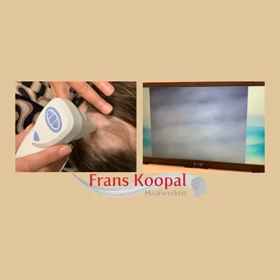 Frans Koopal