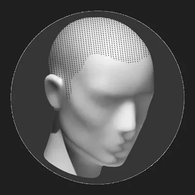 The Scalp Solution
