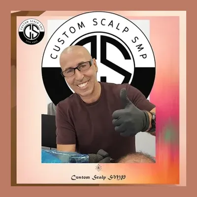 Custom Scalp SMP