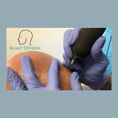 Scalp Diverse Wales