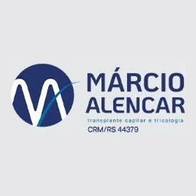 Dr Marcio Alencar Implante Capilar