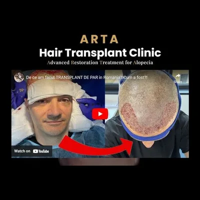 Arta Hair Clinic