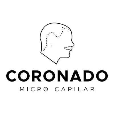 Micropigmentación Capilar Sevilla I Coronado Micro Capilar
