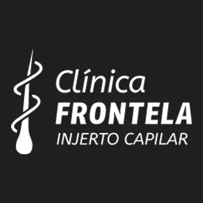 FRONTELA INJERTO CAPILAR HUELVA