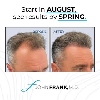 Start in August to see results by Spring! 🌿

Hair restoration is a journey that fully matures over 