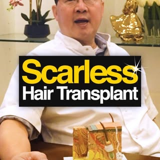 If I Wanted a Scarless Hair Transplant, This Is Exactly What I’d Choose 🤔🧬

No scars. No overharve