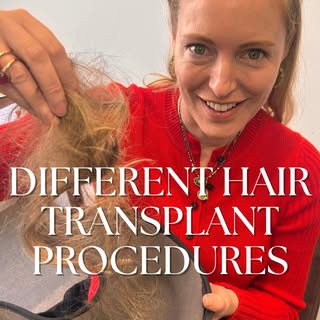 Not all hair transplants are created equal…breaking down the different options for you here :

FUE, 