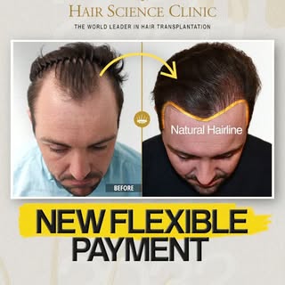 Most people don't fear the cost of a hair transplant — they fear the scars, the shock loss, and mont