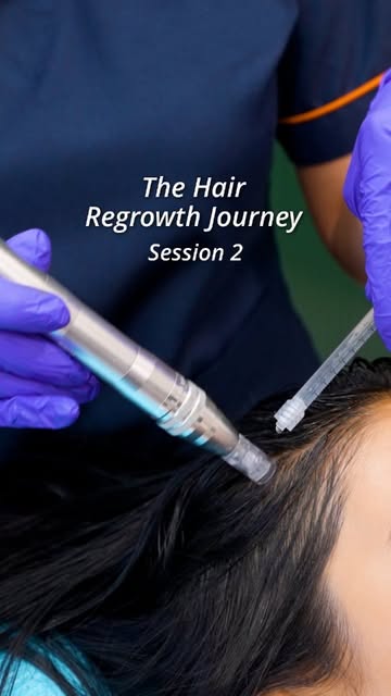 Hair thinning can show up slowly.

A little more shedding.
A wider parting.
Hair that suddenly feels