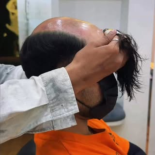 Achieve your dream hairstyle with the Long Hair Patch for Men.

Enjoy natural length, premium textur