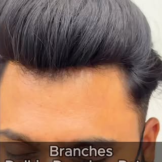 Transform your look with the Miraj Hair Patch for Men — where style meets confidence.

Experience a 