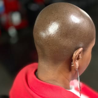 Real density. Not a filter.

This is what scalp micropigmentation looks like for women — coverage th