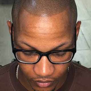 Thinning at the crown? That's not the end of the road. 👆

Male pattern baldness usually hits the to