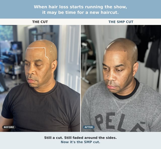 When hair loss starts running the show, it may be time for a new haircut.

Once hair loss gets domin