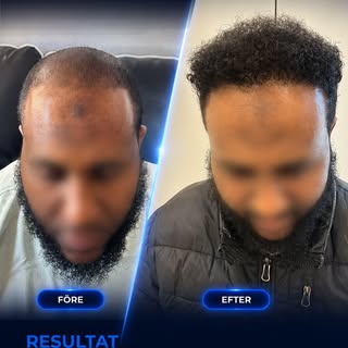 Ibland räcker några sekunder för att se skillnaden. 💛
Bakom denna transformation finns noggrann pla