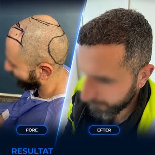 Före och efter. Två bilder. En stor skillnad. 💛

Det du ser här är resultatet av en resa som börjad