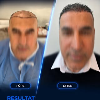 Resultat som talar för sig själva. 💛
Bakom varje före- och efterbild finns planering, erfarenhet oc