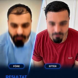 Ett resultat värt att visa. ✨

Från första dagen till resultatet du ser idag – vilken förändring!

E