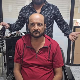 👉 Simple बदल… Powerful लुक 😎
Hair Wig | Hair Patch | Confidence
Mo.7887622535
#HairWig #HairPatch 