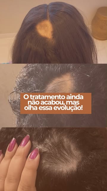 Cada tratamento tem uma história, e cada evolução merece ser compartilhada!

É muito gratificante ac