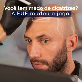 Para quem busca excelência e naturalidade, a técnica é tão importante quanto o cirurgião. 

O método