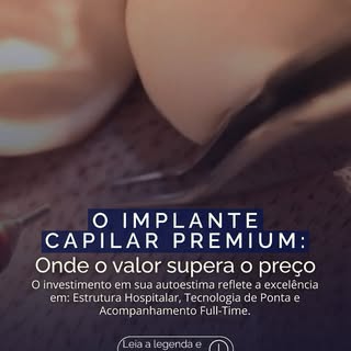 Um resultado que dura a vida toda não é um custo, é um investimento. 

Na Prime Hair, cada etapa do 