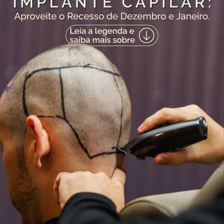 Pensando em fazer seu implante? Dezembro é o mês estratégico! Muitas férias e feriados se unem, gara