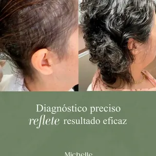 Cada tipo de queda tem uma causa diferente:
hormonal, inflamatória, nutricional, genética…

E cada u