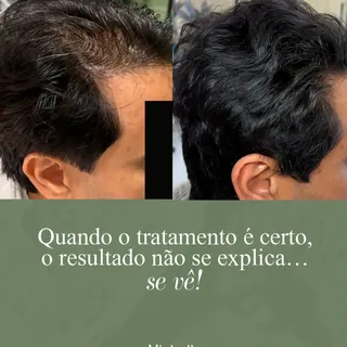 Seu cabelo não mudou do dia para a noite…
E a solução também não é sobre “milagres rápidos”.

A alop