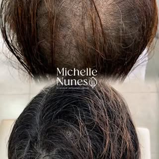 Seu cabelo está caindo mais do que o normal?
Não espere piorar.

Muitas vezes, ela começa por dentro