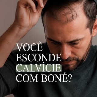 Seu boné virou um disfarce para a calvície?
O transplante não é a única solução para a alopecia andr