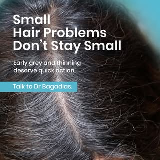 ⏳ Hair concerns rarely fix themselves. The sooner you act on thinning and premature greying, the bet