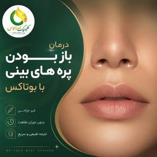 ✨ درمان باز بودن پره‌های بینی با بوتاکس ✨

اگر هنگام خندیدن یا صحبت کردن، پره‌های بینی شما بیش از حد