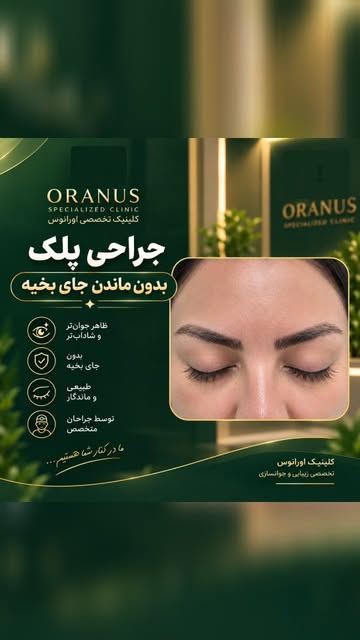 ✨ جراحی پلک؛ ظرافتی که نتیجه‌اش در طبیعی بودن دیده می‌شود ✨
اگر افتادگی پلک، پف یا سنگینی پلک‌ها باع