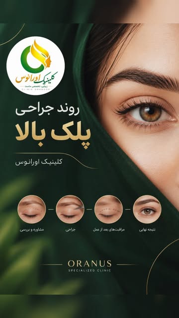 ✨ روند جراحی پلک بالا در کلینیک تخصصی اورانوس

جراحی پلک بالا یا بلفاروپلاستی، با هدف اصلاح افتادگی 
