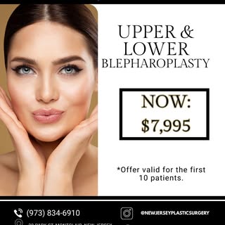 👀 Tired eyes can make you look older or more exhausted than you feel.

An upper and lower blepharop