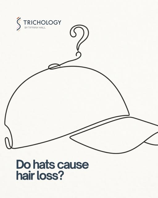 We have all been in hats this summer, and now the weather is turning we will be in hats again. So do