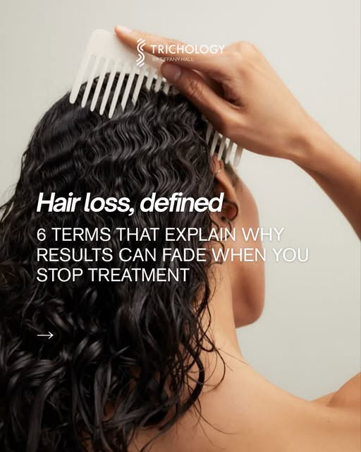 If your hair loss came back after you stopped a treatment, it doesn’t mean the treatment failed.

Mo